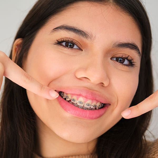 TeenBraces1 Close-up of a smiling young woman showing metal braces on her upper teeth.